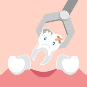 image depicting Southlake dental extractions