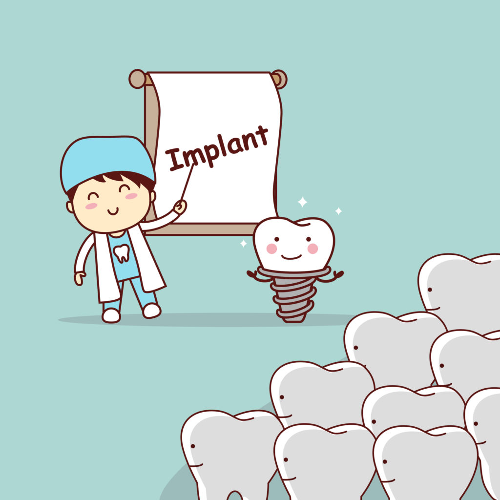 illustrated dentist with dental implant