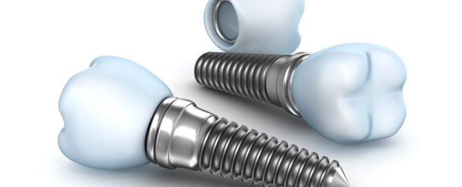 isolated dental implants