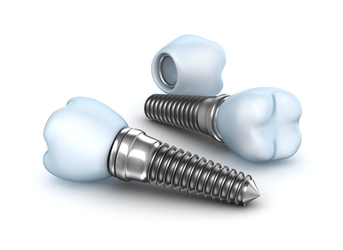 isolated dental implants