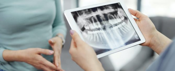Oral surgeon showing patient dental xray