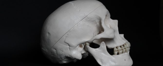 Side view of a human skull, indicating the benefits of dental bone grafting