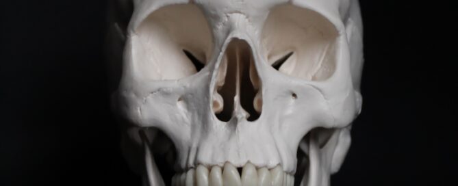 A skull demonstrates where dental bone grafting takes place