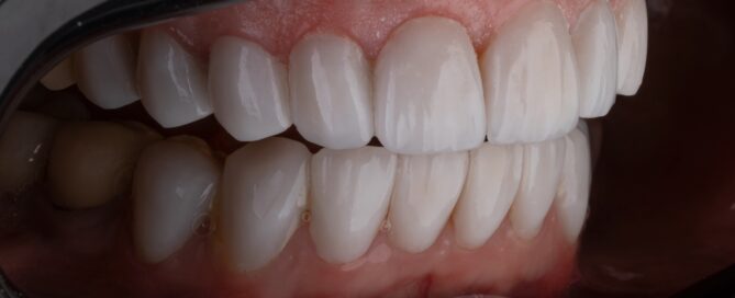 Close-up image of teeth